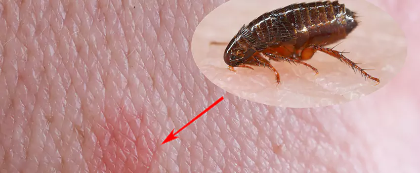 Flea Control for Humans Redlands, CA